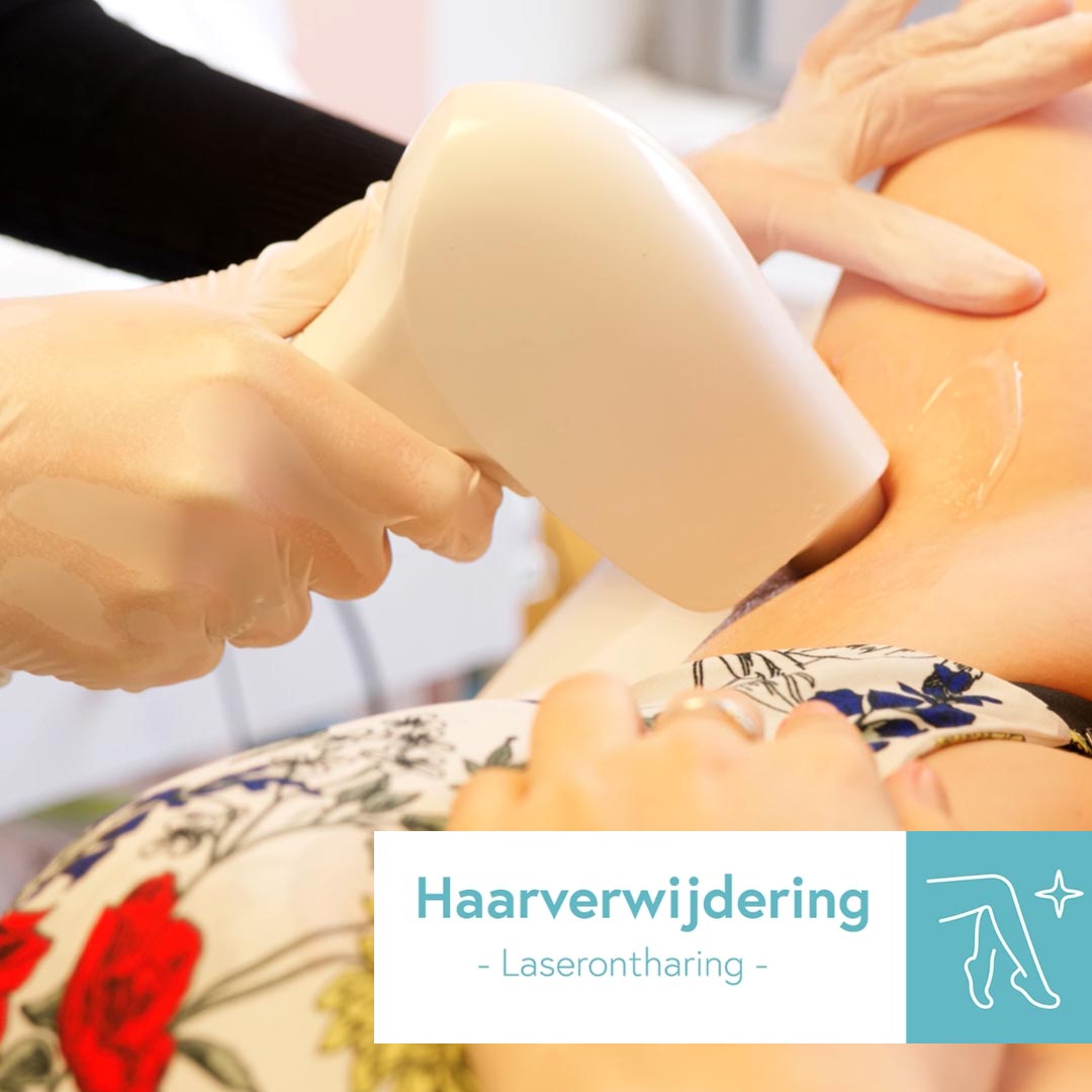 Laser haarverwijdering