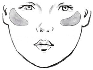 A sketch of cheek bone implants