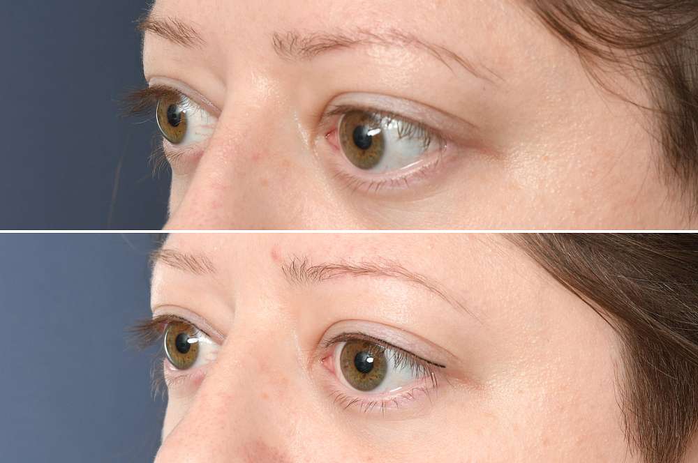 Permanent make-up - Beauty treatments
