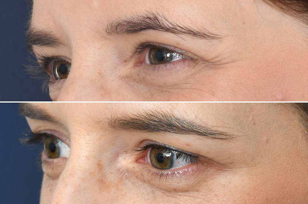 Permanent make-up - Beauty treatments