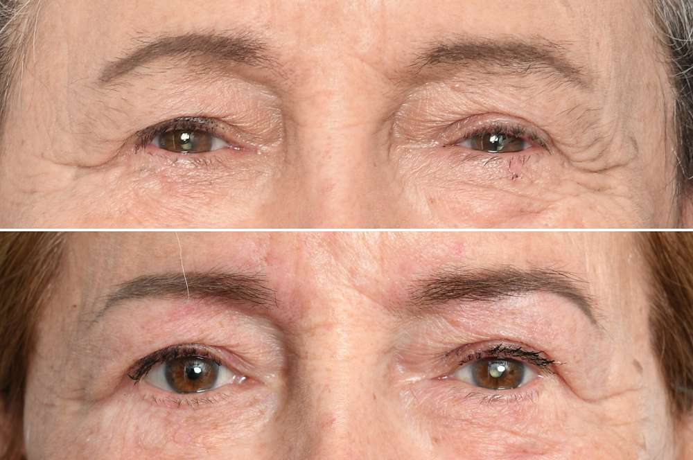 Permanent make-up - Beauty treatments