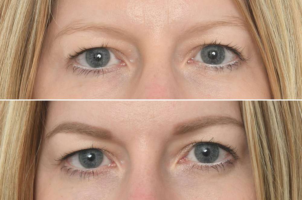 Permanent make-up - Beauty treatments